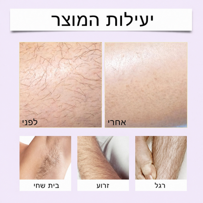Yuri – ערכה להסרת שיער בלי סכין ובלי גירויים לגברים